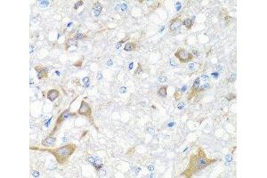 Immunohistochemistry of paraffin-embedded Rat brain using IL22 Polyclonal Antibody at dilution of 1:100 (40x lens). (IL-22 Antikörper)