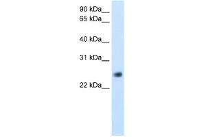 WB Suggested Anti-GGTLA4 Antibody Titration:  5. (GGTLC1 Antikörper  (C-Term))