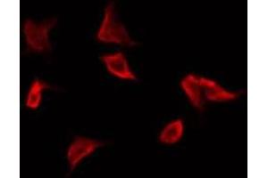 ABIN6269295 staining NIH-3T3 by IF/ICC. (14-3-3 zeta Antikörper  (Internal Region))