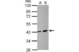 WB Image Sample (30 ug of whole cell lysate) A: HCT116 B: MCF-7 10% SDS PAGE antibody diluted at 1:500 (ZDHHC11 Antikörper)
