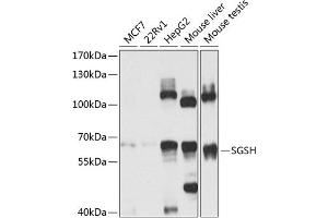 Western blot analysis of extracts of various cell lines, using SGSH antibody (ABIN6129760, ABIN6147711, ABIN6147712 and ABIN6224170) at 1:1000 dilution. (SGSH Antikörper  (AA 273-502))