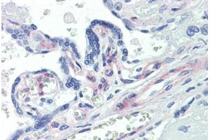Human Placenta (formalin-fixed, paraffin-embedded) stained with PDGFRB antibody ABIN462353 followed by biotinylated anti-mouse IgG secondary antibody ABIN481714, alkaline phosphatase-streptavidin and chromogen. (PDGFRB Antikörper)