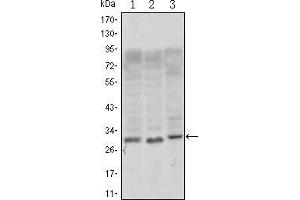 Western blot analysis using CD69 mouse mAb against, Jurkat (1), L1210 (2) and TPH-1 (3) cell lysate. (CD69 Antikörper)