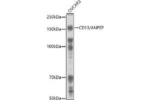 Western blot analysis of extracts of OVC cells, using CD13/ANPEP antibody (ABIN6131185, ABIN6136911, ABIN6136912 and ABIN6221309) at 1:1000 dilution. (CD13 Antikörper  (AA 668-967))
