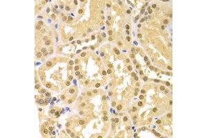Immunohistochemistry of paraffin-embedded human kidney using SFN Antibody. (14-3-3 sigma/SFN Antikörper  (AA 1-248))