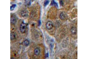 IHC-P analysis of Liver tissue, with DAB staining. (ACP1 Antikörper  (AA 1-158))