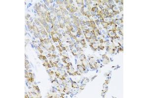 Immunohistochemistry of paraffin-embedded mouse stomach using PIK3CA antibody (ABIN6292231) at dilution of 1:100 (40x lens).