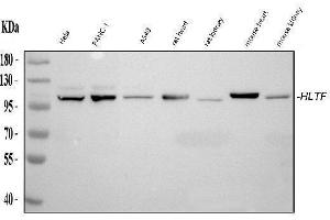 Western blot analysis of HLTF using anti-HLTF antibody (ABIN4886619).