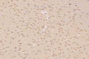 Immunohistochemistry analysis of paraffin-embedded rat substantia nigra using TTL (ABIN7076048) at dilution of 1: 4000
