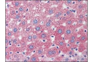 Image no. 1 for anti-Lysosomal-Associated Membrane Protein 1 (LAMP1) (Center) antibody (ABIN303277) (LAMP1 Antikörper  (Center))