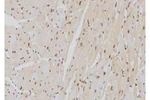 ABIN6277599 at 1/100 staining Mouse heart tissue by IHC-P.