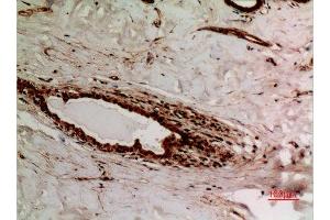 Immunohistochemistry (IHC) analysis of paraffin-embedded Human Breast, antibody was diluted at 1:100. (XRCC6 Antikörper  (acLys539))