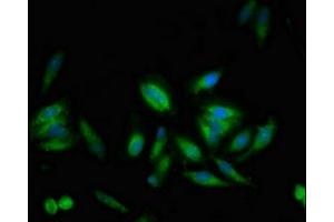 Immunofluorescent analysis of Hela cells using ABIN7174250 at dilution of 1:100 and Alexa Fluor 488-congugated AffiniPure Goat Anti-Rabbit IgG(H+L) (USP1 Antikörper  (AA 453-592))