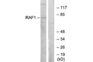 Western Blotting (WB) image for anti-V-Raf-1 Murine Leukemia Viral Oncogene Homolog 1 (RAF1) (AA 311-360) antibody (ABIN2888699) (RAF1 Antikörper  (AA 311-360))