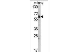 Western Blotting (WB) image for anti-Heat Shock 60kDa Protein 1 (Chaperonin) (HSPD1) (AA 80-109), (N-Term) antibody (ABIN390772)