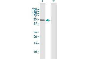 Western Blot analysis of SEPT10 expression in transfected 293T cell line by SEPT10 MaxPab polyclonal antibody. (Septin 10 Antikörper  (AA 1-454))