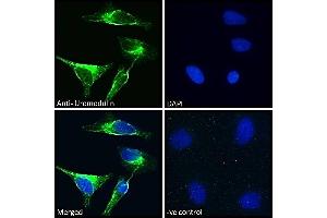 ABIN5539604 Immunofluorescence analysis of paraformaldehyde fixed HeLa cells, permeabilized with 0.