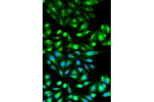 Immunofluorescence analysis of HeLa cells using RHOC antibody. (RHOC Antikörper)