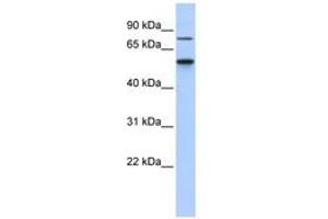 Image no. 1 for anti-Casein Kinase 1, gamma 1 (CSNK1G1) (AA 301-350) antibody (ABIN6740507) (CSNK1G1 Antikörper  (AA 301-350))