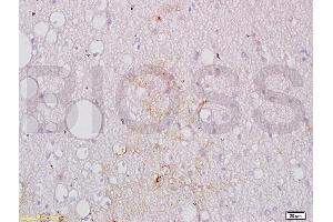 Formalin-fixed and paraffin embedded human brain tissue labeled with Anti-GPIIb Polyclonal Antibody, Unconjugated (ABIN748358) at 1:200 followed by conjugation to the secondary antibody, (SP-0023), and DAB staining (Integrin Alpha2b Antikörper  (AA 351-450))