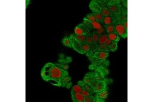 Immunofluorescence Analysis of MeOH-fixed MCF-7 cells. (Cytokeratin 19 Antikörper)