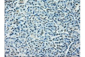 Immunohistochemical staining of paraffin-embedded pancreas tissue using anti-TYRO3mouse monoclonal antibody. (TYRO3 Antikörper)