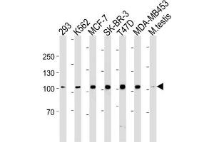 Western Blotting (WB) image for anti-Angiotensin I Converting Enzyme 2 (ACE2) antibody (ABIN3004589) (ACE2 Antikörper)