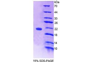SDS-PAGE analysis of Human WTAP Protein. (WTAP Protein)