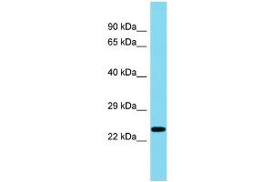 Host: Rabbit Target Name: C8orf46 Sample Type: Fetal Liver lysates Antibody Dilution: 1. (C8ORF46 Antikörper  (C-Term))
