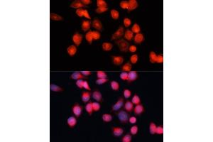 Immunofluorescence analysis of HeLa cells using SLC25 antibody (ABIN7270430) at dilution of 1:100 (40x lens). (SLC25A5 Antikörper  (AA 150-250))