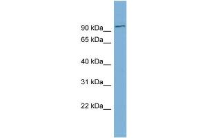 WB Suggested Anti-FBXO34  Antibody Titration: 0. (FBXO34 Antikörper  (Middle Region))