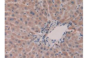 Used in DAB staining on fromalin fixed paraffin- embedded liver tissue (Olfactomedin 4 Antikörper  (AA 407-510))