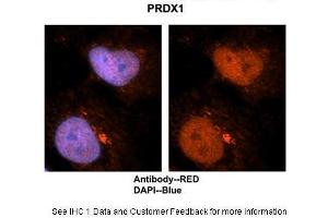 Researcher: Dr. (Peroxiredoxin 1 Antikörper  (N-Term))
