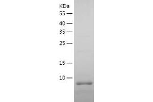 Western Blotting (WB) image for Apolipoprotein C-I (APOC1) (AA 27-83) protein (His tag) (ABIN7121868)