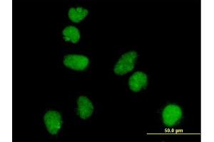 Immunofluorescence of monoclonal antibody to ATR on HeLa cell.
