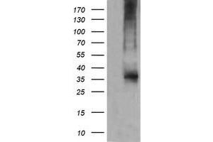Western Blotting (WB) image for anti-T-cell surface glycoprotein CD1c (CD1C) antibody (ABIN2670659) (CD1c Antikörper)