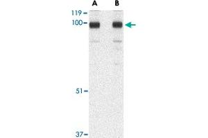 Western blot analysis of STIM2 in A-20 cell lysate with STIM2 polyclonal antibody  at (A) 0. (Stim2 Antikörper  (C-Term))