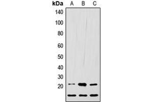 Western blot analysis of LIF expression in HEK293T (A), Raw264. (LIF Antikörper  (C-Term))