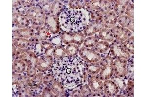 Expression of KCNK13 in rat kidney - Immunohistochemical staining in paraffin-embedded sections of rat kidney using Anti-KCNK13 (THIK-1) (extracellular) Antibody (ABIN7043444, ABIN7045019 and ABIN7045020), (1:50). (KCNK13 Antikörper  (1st Extracellular Loop))