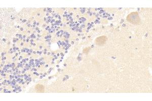 Detection of PLCb3 in Human Cerebellum Tissue using Polyclonal Antibody to Phospholipase C Beta 3, Phosphoinositide Specific (PLCb3) (Phospholipase C beta 3, Phosphoinositide Specific (AA 318-468) Antikörper)