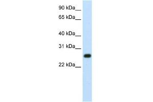 WB Suggested Anti-MINA Antibody Titration:  1. (MINA Antikörper  (N-Term))