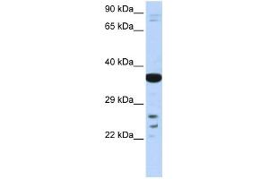 WB Suggested Anti-VSX1 Antibody Titration:  0. (VSX1 Antikörper  (Middle Region))