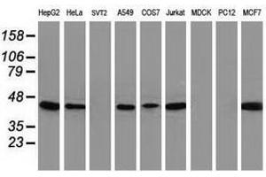 Image no. 4 for anti-ADP-Ribosylation Factor GTPase Activating Protein 1 (ARFGAP1) antibody (ABIN1496684) (ARFGAP1 Antikörper)
