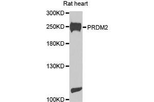 Western blot analysis of extracts of rat heart cells, using PRDM2 antibody. (PRDM2 Antikörper)