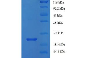SDS-PAGE (SDS) image for phospholipase A2 Receptor 1, 180kDa (PLA2R1) (AA 395-530), (partial) protein (His tag) (ABIN5711323) (PLA2R1 Protein (AA 395-530, partial) (His tag))