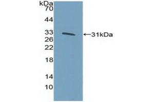 Western blot analysis of recombinant Human KLF5.