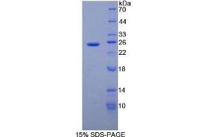 SDS-PAGE (SDS) image for Alcohol Dehydrogenase 1 (Class I) (ADH1) (AA 169-370) protein (His tag) (ABIN2123964) (ADH1 Protein (AA 169-370) (His tag))