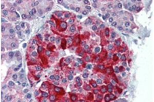 Human Pancreas: Formalin-Fixed, Paraffin-Embedded (FFPE) (RBP4 Antikörper  (AA 19-202))