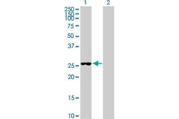 FUBP3 Antikörper  (AA 1-261)
