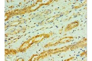 Immunohistochemistry of paraffin-embedded human kidney tissue using ABIN7146759 at dilution of 1:100 (CPA1 Antikörper  (AA 111-419))